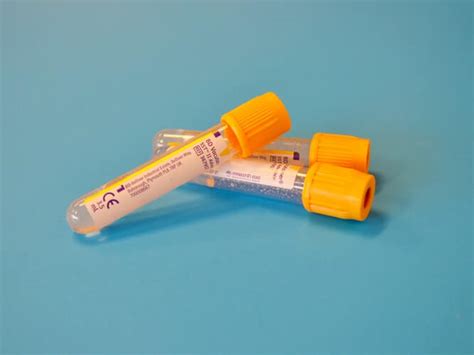 Our <b>drug</b> <b>test</b> centers can provide testing with urine and hair for <b>drugs</b> and for alcohol including EtG alcohol testing. . Nyc tlc drug test locations